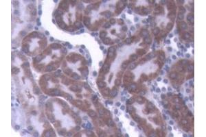 DAB staining on IHC-P; Samples: Rat Kidney Tissue (IL-1 beta antibody  (AA 117-268))