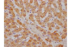 IHC image of ABIN7127317 diluted at 1:100 and staining in paraffin-embedded human liver tissue performed on a Leica BondTM system. (Recombinant ABAT antibody)