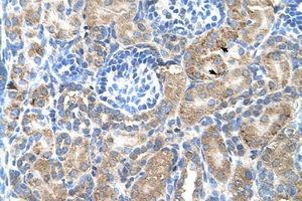SGPP2 antibody  (AA 301-350)