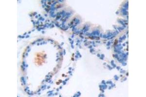 Figure. (ICAM4 antibody  (AA 32-226))