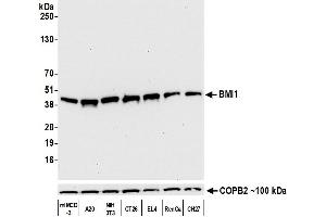 Western Blotting (WB) image for anti-BMI1 Polycomb Ring Finger Oncogene (BMI1) (AA 250-300) antibody (ABIN7455106) (Recombinant BMI1 antibody  (AA 250-300))