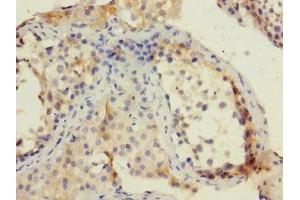 Immunohistochemistry of paraffin-embedded human testis tissue using ABIN7151292 at dilution of 1:100 (TRIP12 antibody  (AA 1-240))