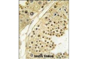 Formalin-fixed and paraffin-embedded human testis tissue reacted with STK12 Antibody (N-term) (ABIN391353 and ABIN2841374) , which was peroxidase-conjugated to the secondary antibody, followed by DAB staining. (Aurora-B (ARK/STK12) (AA 6-35), (N-Term) antibody)