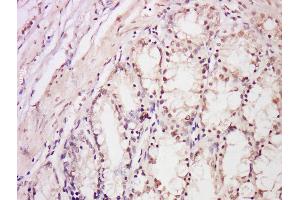 Formalin-fixed and paraffin embedded rat intestine labeled with Anti-DDB2 Polyclonal Antibody, Unconjugated  at 1:300 followed by conjugation to the secondary antibody and DAB staining. (DDB2 antibody  (AA 201-300))