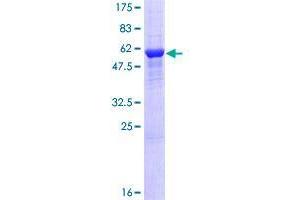 RPRD1A Protein (AA 1-289) (GST tag)