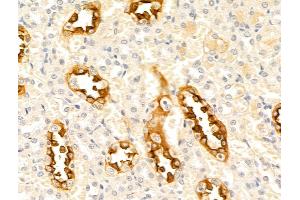 ABIN7094793 and ABIN7098844 at 1/100 staining Rat kidney tissue by IHC-P.
