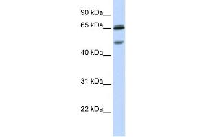 WB Suggested Anti-GABRG2 Antibody Titration:  0. (GABRG2 antibody  (N-Term))