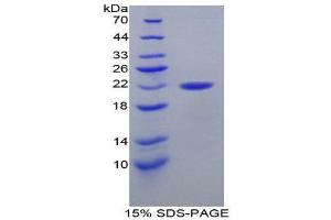 SDS-PAGE (SDS) image for Parkinson Protein 7 (PARK7) (AA 1-189) protein (His tag) (ABIN1080470) (PARK7/DJ1 Protein (AA 1-189) (His tag))