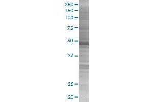 KRT17 transfected lysate.