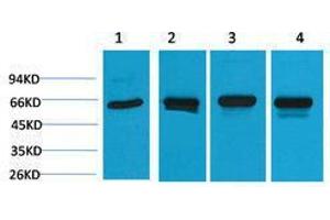 Western Blotting (WB) image for anti-Heat Shock 60kDa Protein 1 (Chaperonin) (HSPD1) antibody (ABIN3181507) (HSPD1 antibody)