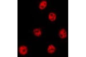 ABIN6275019 staining Hela by IF/ICC. (CSTF2T antibody  (N-Term))