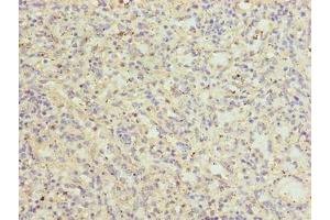 Immunohistochemistry of paraffin-embedded human spleen tissue using ABIN7147031 at dilution of 1:100 (CATSPER2 antibody  (AA 5-112))