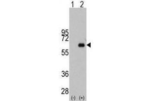 Image no. 1 for anti-Myc Proto-Oncogene protein (MYC) antibody (ABIN357363) (c-MYC antibody)