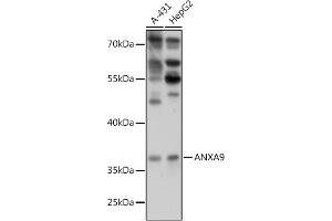 Western blot analysis of extracts of various cell lines, using  antibody (ABIN7265625) at 1:1000 dilution. (Annexin A9 antibody  (AA 1-100))