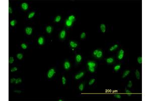 Immunofluorescence of monoclonal antibody to GABPA on HeLa cell. (GABPA antibody  (AA 1-100))