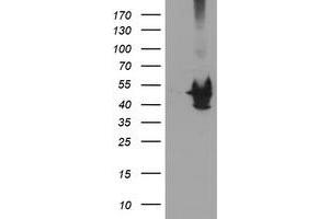 Western Blotting (WB) image for anti-Potassium Voltage-Gated Channel, Shaker-Related Subfamily, beta Member 1 (KCNAB1) antibody (ABIN1499001) (KCNAB1 antibody)