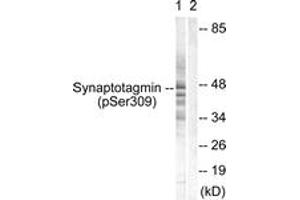 Western blot analysis of extracts from 293 cells treated with Sobital 0. (Synaptotagmin antibody  (pSer309))