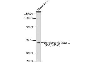 Western blot analysis of extracts of Mouse testis, using Steroidogenic factor-1 (SF-1/NR5) antibody (657) at 1:1000 dilution. (NR5A1 antibody  (AA 1-120))