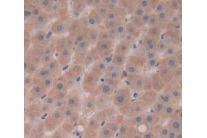 Used in DAB staining on fromalin fixed paraffin- embedded Kidney tissue (Complement Factor I antibody  (AA 28-243))
