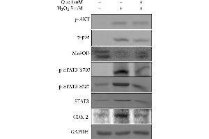 Effects of quercetin on the inflammatory response in H2O2-treated H9C2 cells. (PTGS2 antibody  (C-Term))