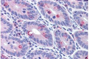 Mouse small intestine: Formalin-Fixed, Paraffin-Embedded (FFPE) (IFIH1 antibody  (C-Term))