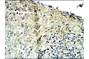 Detecting C4a in Baboon Liver using ABIN2749472 (C4A antibody  (AA 1220-1270))
