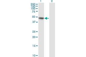 Western Blot analysis of CBLC expression in transfected 293T cell line by CBLC monoclonal antibody (M01), clone 3F10. (CBLC antibody  (AA 1-474))