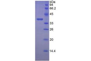 SDS-PAGE analysis of Mouse Lumican Protein. (LUM Protein)