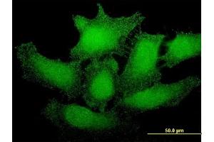 Immunofluorescence of monoclonal antibody to SMG1 on HeLa cell. (SMG1 antibody  (AA 2922-3031))