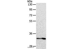 Western blot analysis of Human fetal intestine tissue, using IL1RL1 Polyclonal Antibody at dilution of 1:700 (IL1RL1 antibody)