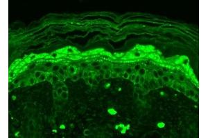 Immunohistochemistry analysis using Mouse Anti-GluN2B/NR2B Monoclonal Antibody, Clone S59-36 (ABIN863130). (GRIN2B antibody  (AA 20-271))