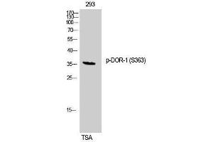 Western Blotting (WB) image for anti-Opioid Receptor, delta 1 (OPRD1) (pSer363) antibody (ABIN3182512) (OPRD1 antibody  (pSer363))