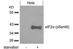Image no. 3 for anti-Eukaryotic Translation Initiation Factor 2 Subunit 1 (EIF2S1) (pSer49) antibody (ABIN319275) (EIF2S1 antibody  (pSer49))