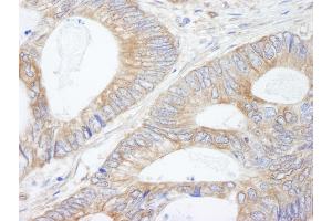 Immunohistochemistry (IHC) image for anti-KIAA1524 (KIAA1524) (AA 550-600) antibody (ABIN7448939)