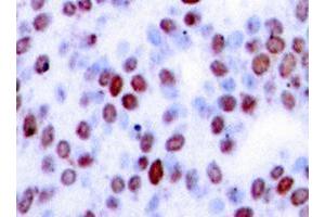 Image no. 1 for anti-Jun Proto-Oncogene (JUN) antibody (ABIN265353) (C-JUN antibody)