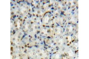 #VALUE! (PIN1 antibody  (AA 2-163))