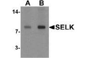 Western blot analysis of SELK in A20 cell lysate with SELK antibody at (A) 1 and (B) 2 μg/ml. (Selenoprotein K antibody  (C-Term))