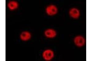 ABIN6277174 staining Hela by IF/ICC. (TBP antibody  (N-Term))