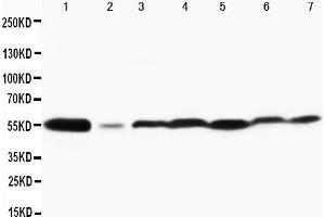 Anti-MAPK8/9 antibody, Western blotting Lane 1: Rat Brain Tissue Lysate Lane 2: Rat Thymus Tissue Lysate Lane 3: MCF-7 Cell Lysate Lane 4: HELA Cell Lysate Lane 5: JURKAT Cell Lysate Lane 6: MM231 Cell Lysate Lane 7: CEM Cell Lysate (JNK antibody  (Middle Region))