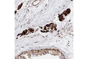 Immunohistochemical staining of human testis with LRRC56 polyclonal antibody  shows strong cytoplasmic positivity in Leydig cells at 1:200-1:500 dilution. (LRRC56 antibody)