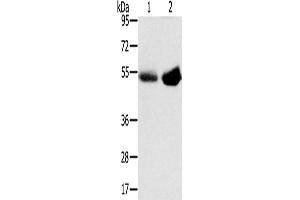 Western Blotting (WB) image for anti-Solute Carrier Family 13 Member 3 (SLC13A3) antibody (ABIN2427263) (SLC13A3 antibody)