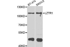 Western blot analysis of extracts of BT474 and SKOV3 cell lines, using LZTR1 antibody. (LZTR1 antibody)