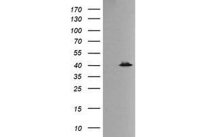 Image no. 2 for anti-Mitogen-Activated Protein Kinase 13 (MAPK13) antibody (ABIN1499952) (MAPK13 antibody)
