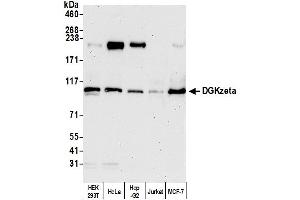 Western Blotting (WB) image for anti-Diacylglycerol Kinase, zeta (DGKZ) (AA 1067-1117) antibody (ABIN7454557) (DGKZ antibody  (AA 1067-1117))