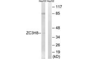 Western Blotting (WB) image for anti-Zinc Finger CCCH-Type Containing 8 (ZC3H8) (AA 81-130) antibody (ABIN2879217)