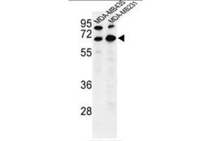 Western blot analysis of BEST2 Antibody (C-term) in MDA-MB435,MDA-MB231 cell line lysates (35µg/lane).