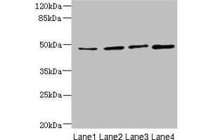 Western blot All lanes: TTC5 antibody at 6 μg/mL Lane 1: HepG2 whole cell lysate Lane 2: A549 whole cell lysate Lane 3: MCF-7 whole cell lysate Lane 4: Mouse kidney tissue Secondary Goat polyclonal to rabbit IgG at 1/10000 dilution Predicted band size: 49 kDa Observed band size: 49 kDa (TTC5 antibody  (AA 201-440))
