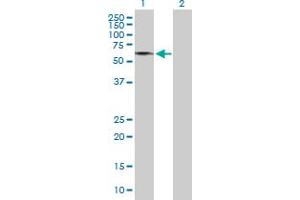 Western Blot analysis of GDPD2 expression in transfected 293T cell line by GDPD2 MaxPab polyclonal antibody. (GDPD2 antibody  (AA 1-539))