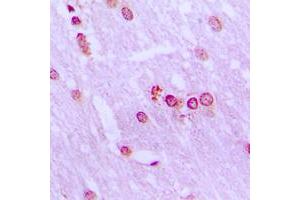 Immunohistochemical analysis of BRD3 staining in human brain formalin fixed paraffin embedded tissue section. (BRD3 antibody  (C-Term))