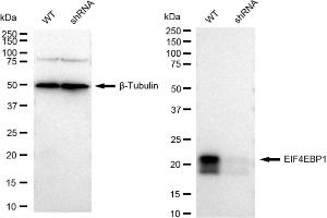 Western blotting analysis using EIF4EBP1 antibody (ABIN7798531). (Recombinant eIF4EBP1 antibody)